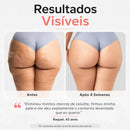 Aparelho Redutor De Celulite ReduSculpt