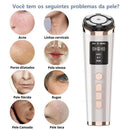 Mini Hifu Ultrassom Portátil Microfocado para o Rosto